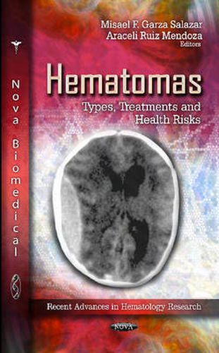 Cover image for Hematomas: Types, Treatments & Health Risks