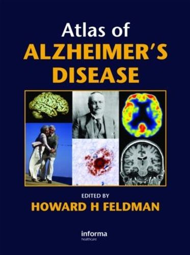 Cover image for Atlas of Alzheimer's Disease
