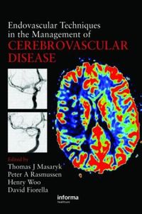 Cover image for Endovascular Techniques in the Management of Cerebrovascular Disease