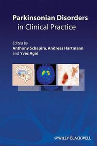 Cover image for Parkinsonian Disorders in Clinical Practice