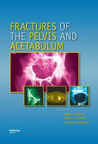 Cover image for Fractures of the Pelvis and Acetabulum