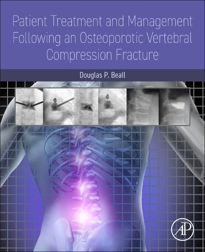 Cover image for Patient Treatment and Management Following an Osteoporotic Vertebral Compression Fracture