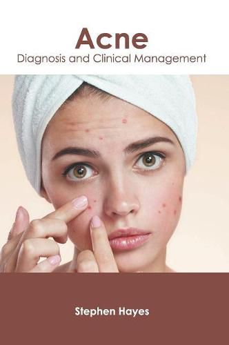 Cover image for Acne: Diagnosis and Clinical Management