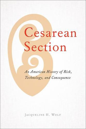 Cover image for Cesarean Section: An American History of Risk, Technology, and Consequence