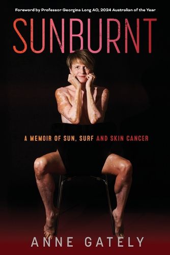 Cover image for Sunburnt