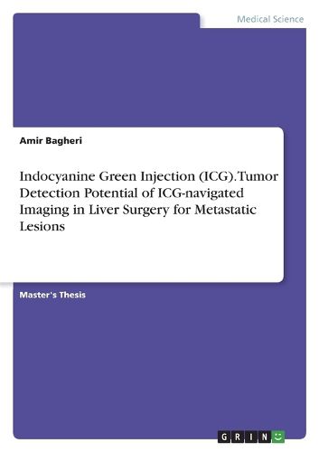 Cover image for Indocyanine Green Injection (ICG). Tumor Detection Potential of ICG-navigated Imaging in Liver Surgery for Metastatic Lesions