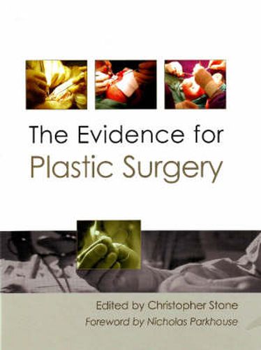 Cover image for Evidence for Plastic Surgery