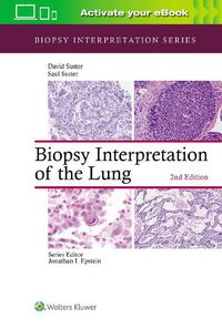 Cover image for Biopsy Interpretation of the Lung