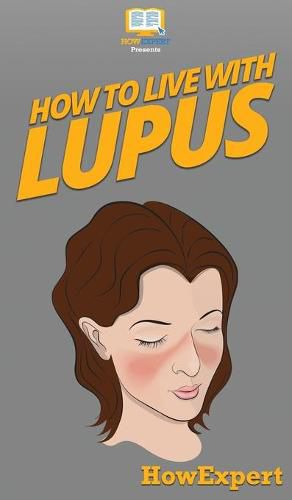 How To Live With Lupus: Your Step By Step Guide To Living With Lupus