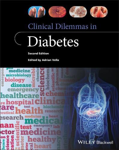 Cover image for Clinical Dilemmas in Diabetes 2e