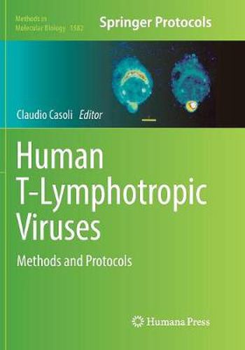 Cover image for Human T-Lymphotropic Viruses: Methods and Protocols
