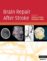 Cover image for Brain Repair After Stroke