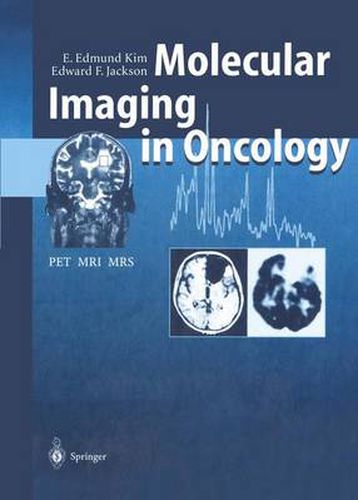 Cover image for Molecular Imaging in Oncology: PET, MRI, and MRS