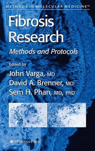 Cover image for Fibrosis Research: Methods and Protocols