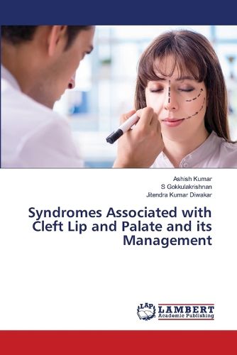 Cover image for Syndromes Associated with Cleft Lip and Palate and its Management