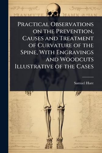 Cover image for Practical Observations on the Prevention, Causes and Treatment of Curvature of the Spine, With Engravings and Woodcuts Illustrative of the Cases