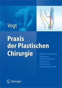 Cover image for Praxis der Plastischen Chirurgie: Plastisch-rekonstruktive Operationen - Plastisch-asthetische Operationen - Handchirurgie - Verbrennungschirurgie