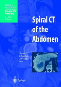 Cover image for Spiral CT of the Abdomen