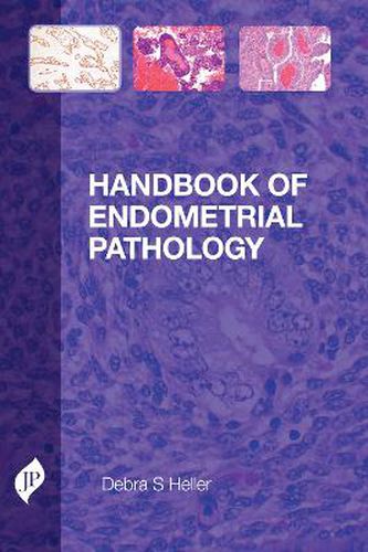Cover image for Handbook of Endometrial Pathology