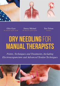 Cover image for Dry Needling for Manual Therapists: Points, Techniques and Treatments, Including Electroacupuncture and Advanced Tendon Techniques