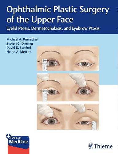 Cover image for Ophthalmic Plastic Surgery of the Upper Face: Eyelid Ptosis, Dermatochalasis, and Eyebrow Ptosis