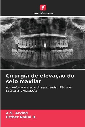Cover image for Cirurgia de elevacao do seio maxilar