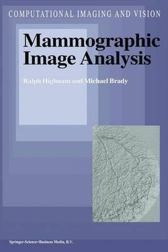 Cover image for Mammographic Image Analysis