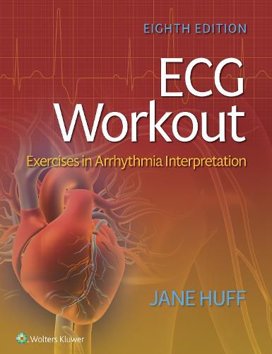 Cover image for ECG Workout: Exercises in Arrhythmia Interpretation