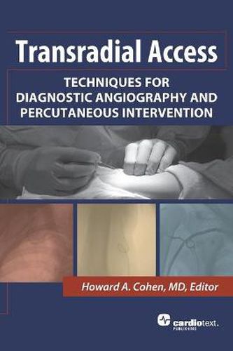 Cover image for Transradial Access: Techniques for Diagnostic Angiography and Percutaneous Intervention