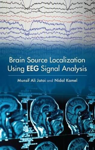 Cover image for Brain Source Localization Using EEG Signal Analysis