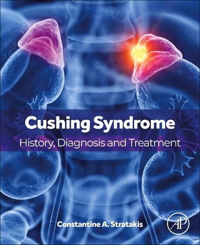 Cover image for Cushing Syndrome