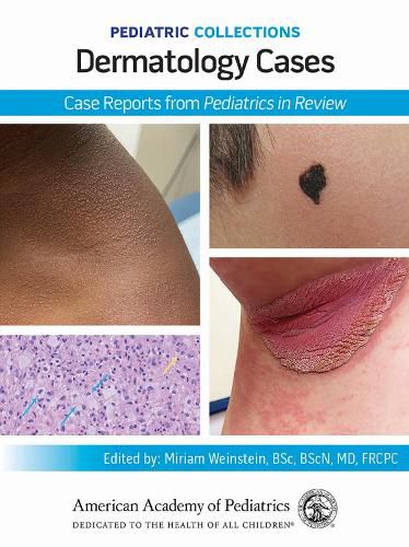 Dermatology Cases