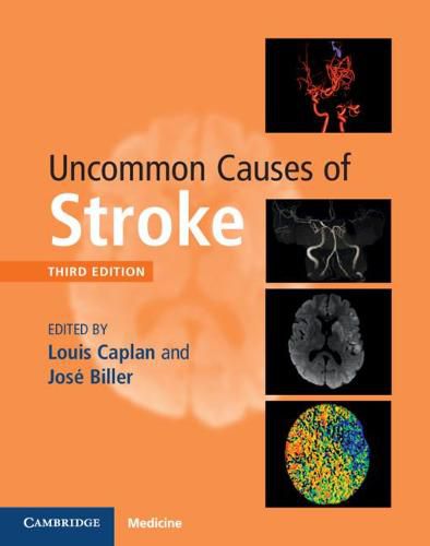 Cover image for Uncommon Causes of Stroke