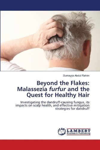 Cover image for Beyond the Flakes