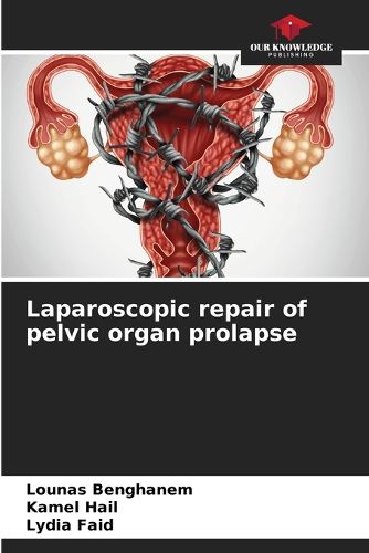 Cover image for Laparoscopic repair of pelvic organ prolapse