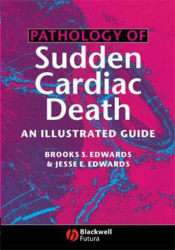 Cover image for Pathology of Sudden Cardiac Death