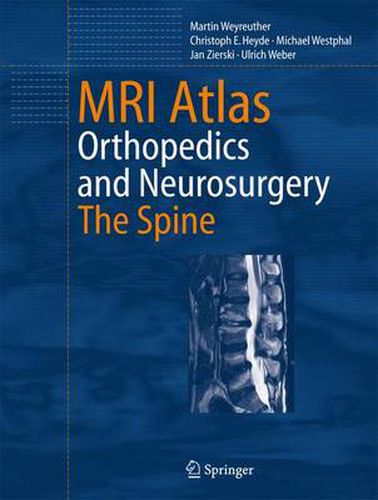 Cover image for MRI Atlas: Orthopedics and Neurosurgery, The Spine