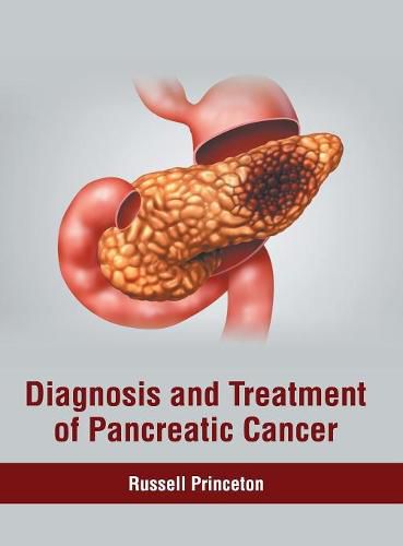 Cover image for Diagnosis and Treatment of Pancreatic Cancer