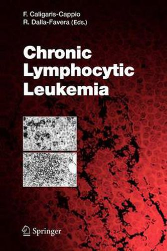 Cover image for Chronic Lymphocytic Leukemia