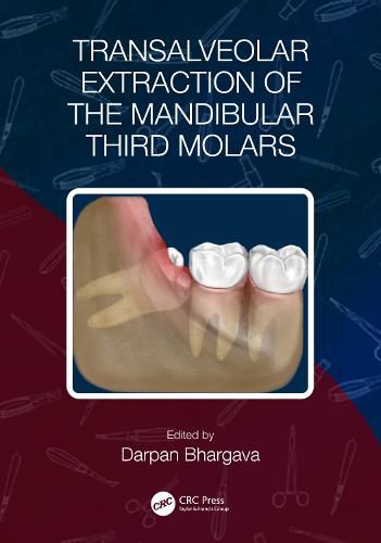 Cover image for Transalveolar Extraction of the Mandibular Third Molars