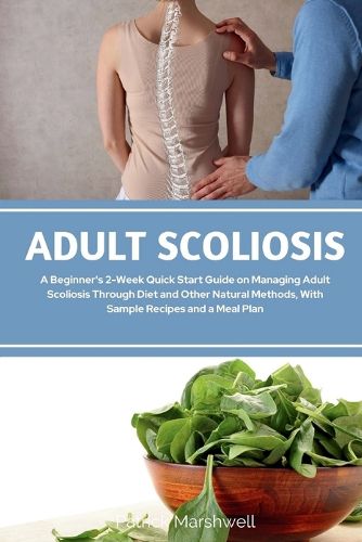 Cover image for Adult Scoliosis
