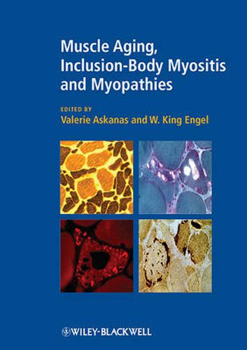 Cover image for Muscle Aging, Inclusion-Body Myositis and Myopathies