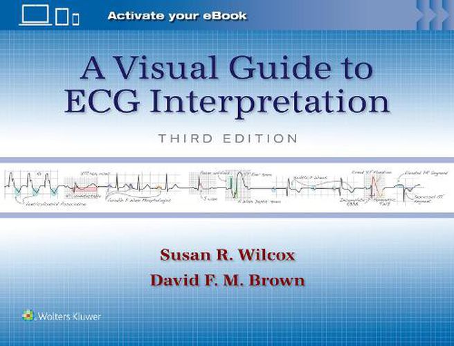 A Visual Guide to ECG Interpretation: Print + eBook with Multimedia