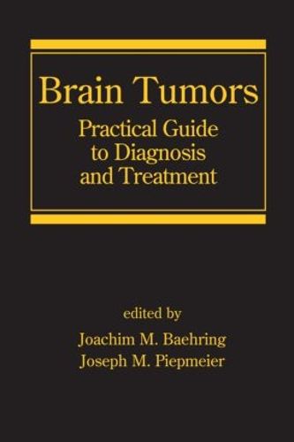 Cover image for Brain Tumors: Practical Guide to Diagnosis and Treatment