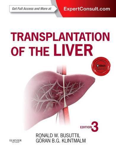 Cover image for Transplantation of the Liver