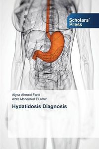 Cover image for Hydatidosis Diagnosis