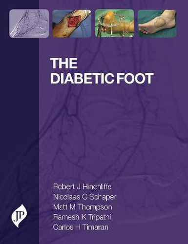 Cover image for The Diabetic Foot