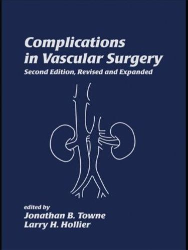 Cover image for Complications in Vascular Surgery