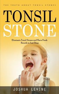 Cover image for Tonsil Stones