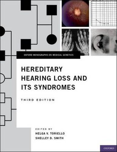 Cover image for Hereditary Hearing Loss and Its Syndromes